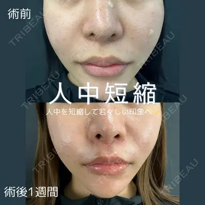 ルラ美容クリニック 仙台院 / ルラスキンクリニック 仙台院 橋本 英樹医師の症例