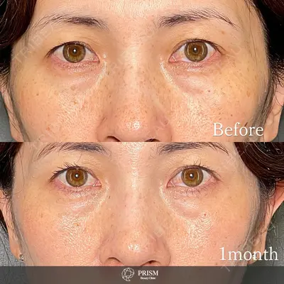 PRISM Beauty Clinic 新宿院 畑山 知輝医師の症例