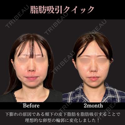 PRISM Beauty Clinic 新宿院 畑山 知輝医師の症例