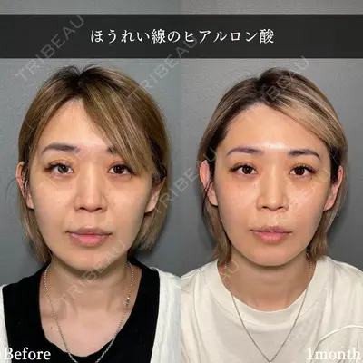 PRISM Beauty Clinic 新宿院 畑山 知輝医師の症例