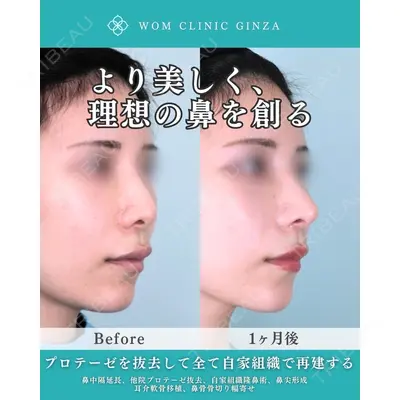 WOM CLINIC GINZA （ワム クリニック ギンザ） 中井 孝昌医師の症例