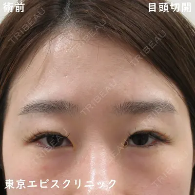 東京エビスクリニック 照屋 智医師の症例