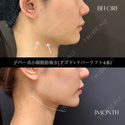 RIVER CLINIC（リバークリニック） 戸田 貴之医師の症例