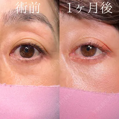 HAAB×DREAM BEAUTY CLINIC 大阪梅田院 鈴木 馨斗医師の症例