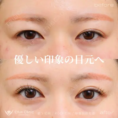 Otus Clinic 【オータスクリニック】 中 徳太郎医師の症例