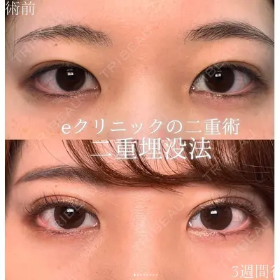 eクリニック 名古屋院 服部 健人医師の症例