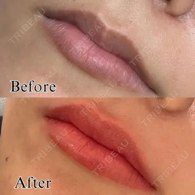 NARU Beauty Clinic 【ナルクリ】 水戸院 地引 輔医師の症例