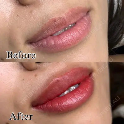 NARU Beauty Clinic 【ナルクリ】 水戸院 地引 輔医師の症例