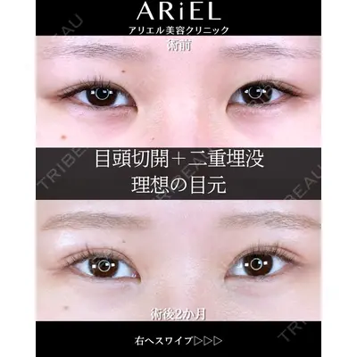 アリエル美容クリニック 大宮院 阪野 一世医師の症例
