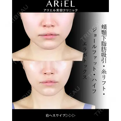 アリエル美容クリニック 大宮院 鈴木　桂介医師の症例
