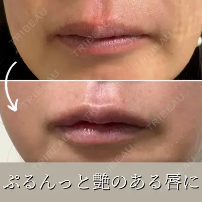 目白ホワイトクリニック 中島 ちかこ医師の症例