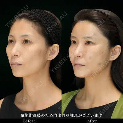 ルラ美容クリニック 池袋院 小海 元｜長期休暇につき指名不可医師の症例