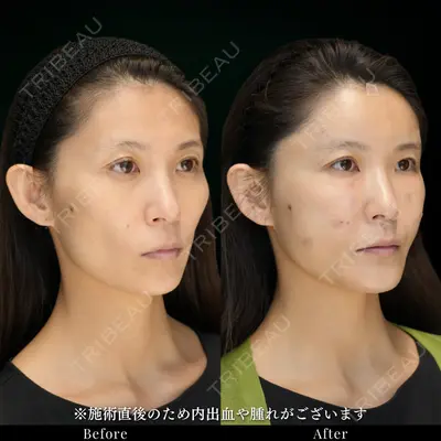 ルラ美容クリニック 池袋院 小海 元｜長期休暇につき指名不可医師の症例