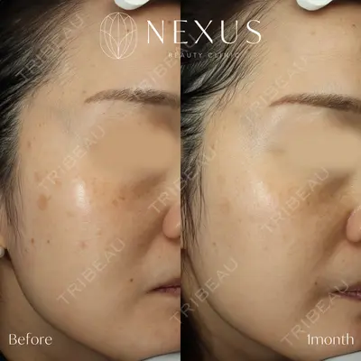 NEXUS CLINICの症例