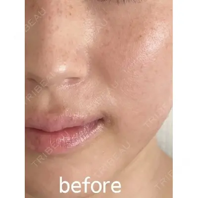 ON-CLINIC Beautyの症例