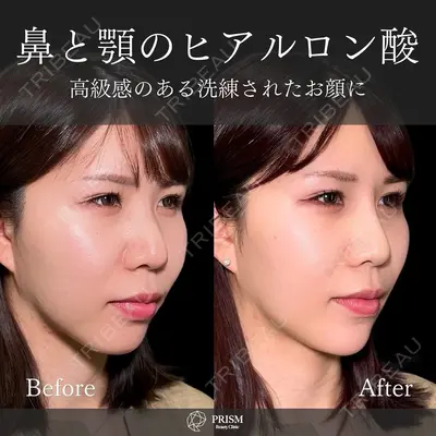 PRISM Beauty Clinic 新宿院 畑山 知輝医師の症例