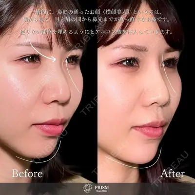 PRISM Beauty Clinic 新宿院 畑山 知輝医師の症例