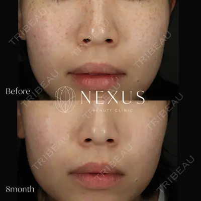 NEXUS CLINICの症例