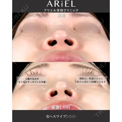 アリエル美容クリニック 大宮院 阪野 一世医師の症例