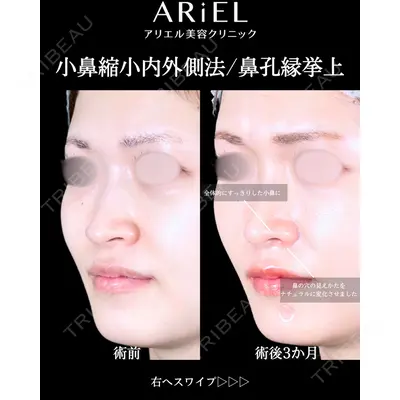 アリエル美容クリニック 大宮院 阪野 一世医師の症例