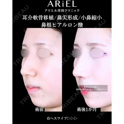 アリエル美容クリニック 大宮院 阪野 一世医師の症例