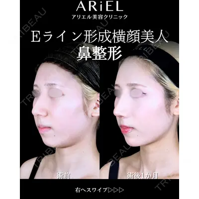 アリエル美容クリニック 大宮院 阪野 一世医師の症例