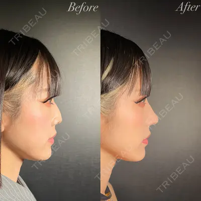 R Beauty CLINIC 銀座院 吉田　慧医師の症例