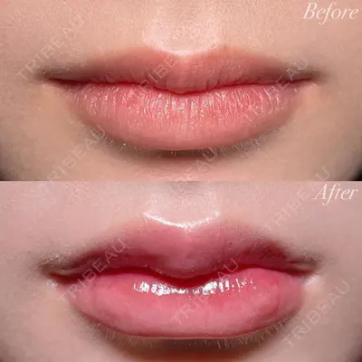 R Beauty CLINIC 大阪院 小池 泰弘医師の症例