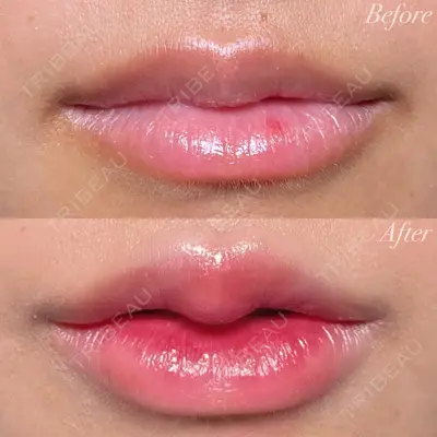 R Beauty CLINIC 大阪院 小池 泰弘医師の症例