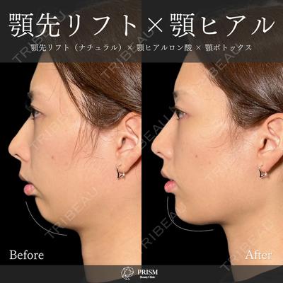 PRISM Beauty Clinic 新宿院 畑山 知輝医師の症例
