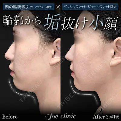 ジョウクリニック 高知院 溝渕　貴俊医師の症例