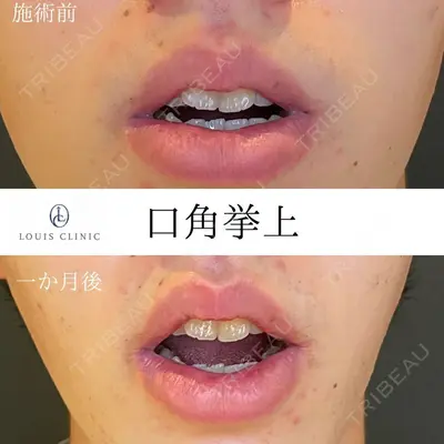 LOUIS CLINIC 二子玉川院【ルイクリニック】 小松 塁医師の症例