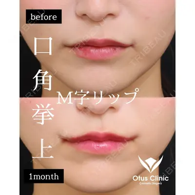 Otus Clinic 【オータスクリニック】 中 徳太郎医師の症例
