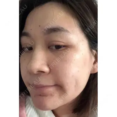 しんゆり美容健康クリニックの症例