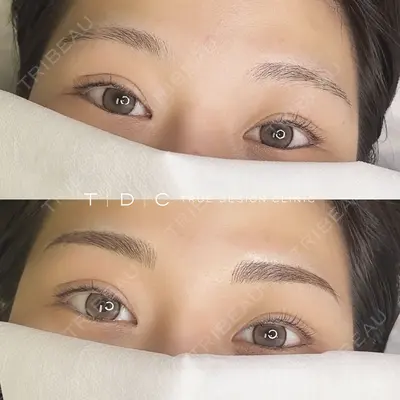 TRUE DESIGN CLINIC 山本医師の症例