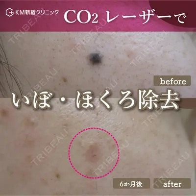 KM新宿クリニック 内藤　崇医師の症例