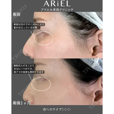 アリエル美容クリニック 郡山院の症例
