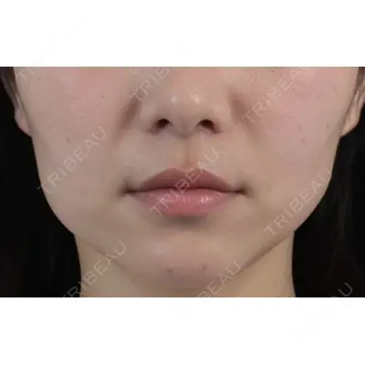 しんゆり美容健康クリニックの症例