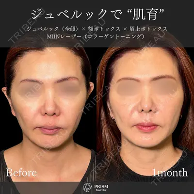 PRISM Beauty Clinic 新宿院 畑山 知輝医師の症例