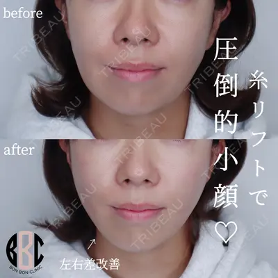 BON BON CLINIC 銀座駅前本院 池田 悠医師の症例