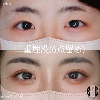 BON BON CLINIC 銀座駅前本院 池田 悠医師の症例