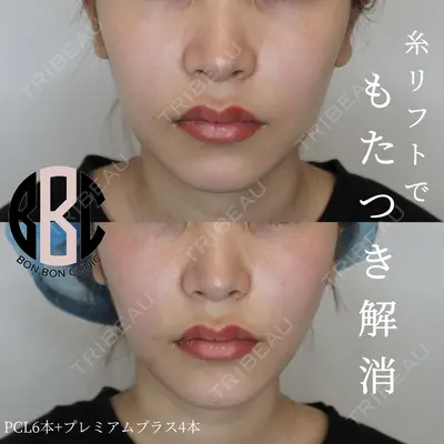 BON BON CLINIC 銀座駅前本院 岡本 光平医師の症例