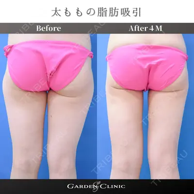 ガーデンクリニック 池袋院 松口 崇央医師の症例