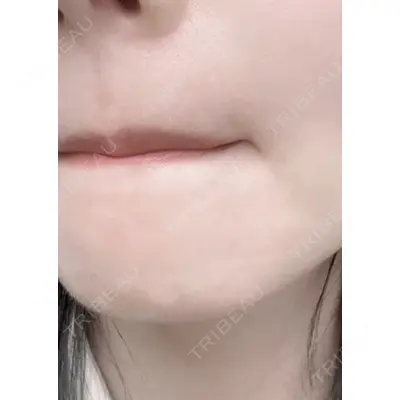 しんゆり美容健康クリニックの症例