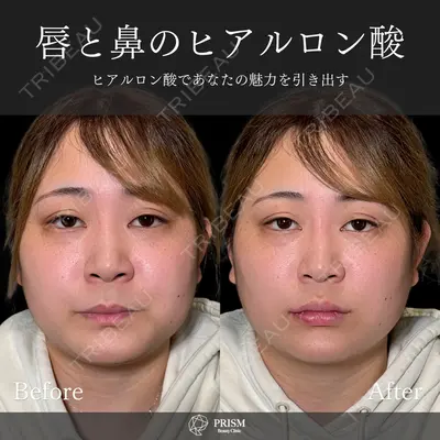 PRISM Beauty Clinic 新宿院 畑山 知輝医師の症例