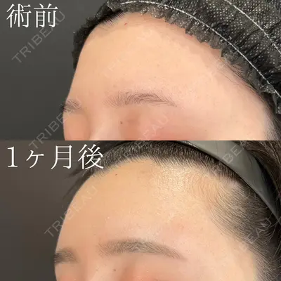HAAB×DREAM BEAUTY CLINIC 大阪梅田院 鈴木 馨斗医師の症例