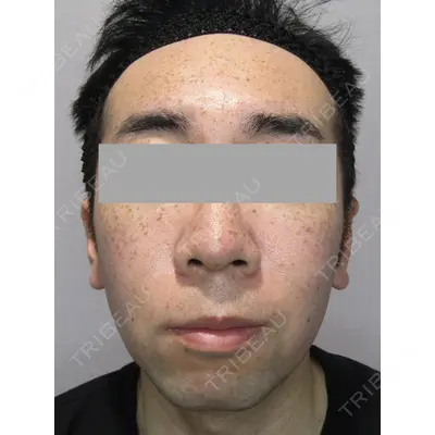 Wi Clinic（ウィ クリニック） 銀座院の症例