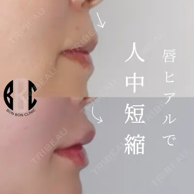 BON BON CLINIC 銀座駅前本院 岡本 光平医師の症例