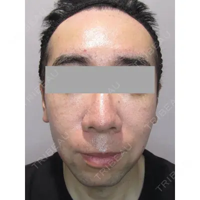 Wi Clinic（ウィ クリニック） 銀座院の症例