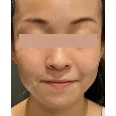 Wi Clinic（ウィ クリニック） 銀座院の症例